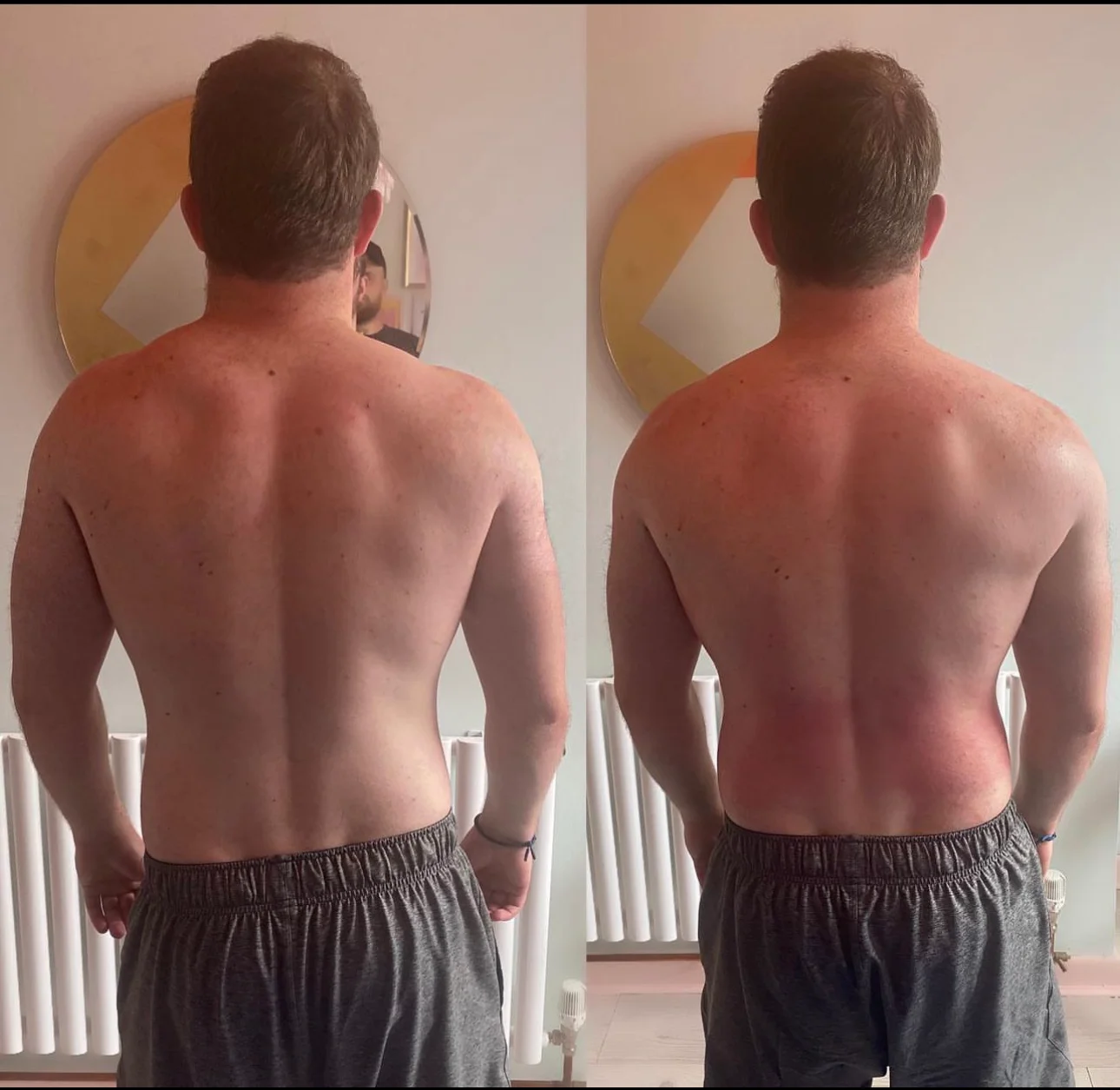 Image showing clients results before and after full body mot treatment