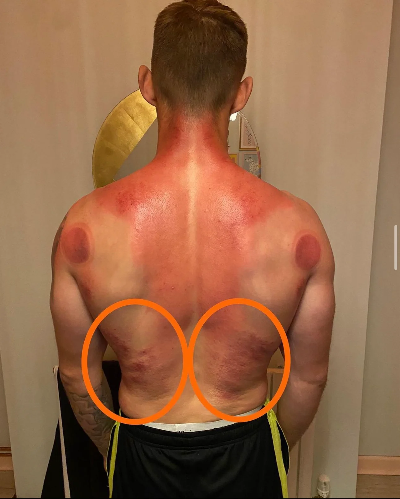 Image showing clients results before and after one hour appointment