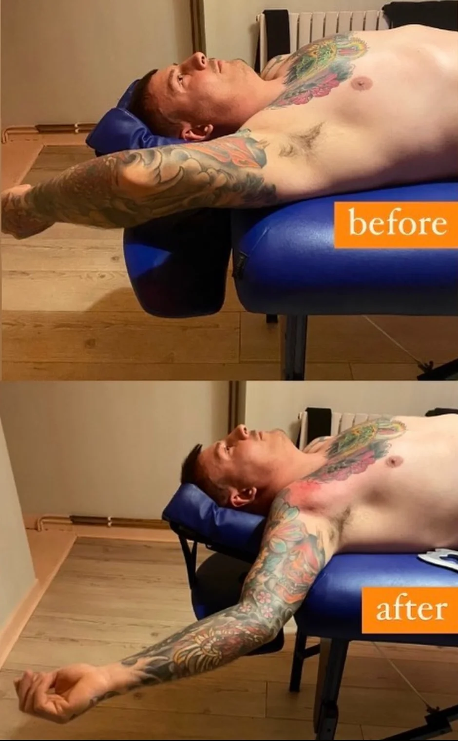 Image showing client before and after of a shoulder injury treatment